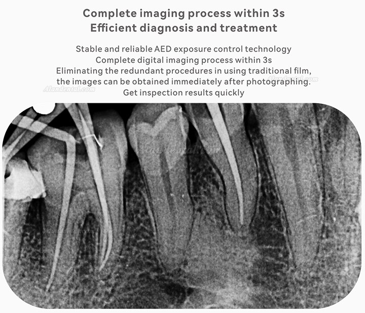 Woodpecker i-Sensor H1/H2 Dental Intraoral X-ray Imaging RVG Sensor + Software